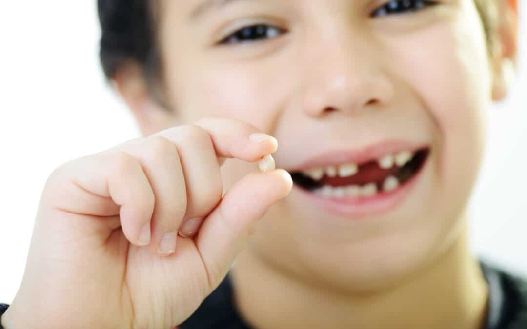 When Do Kids Start Losing Teeth?